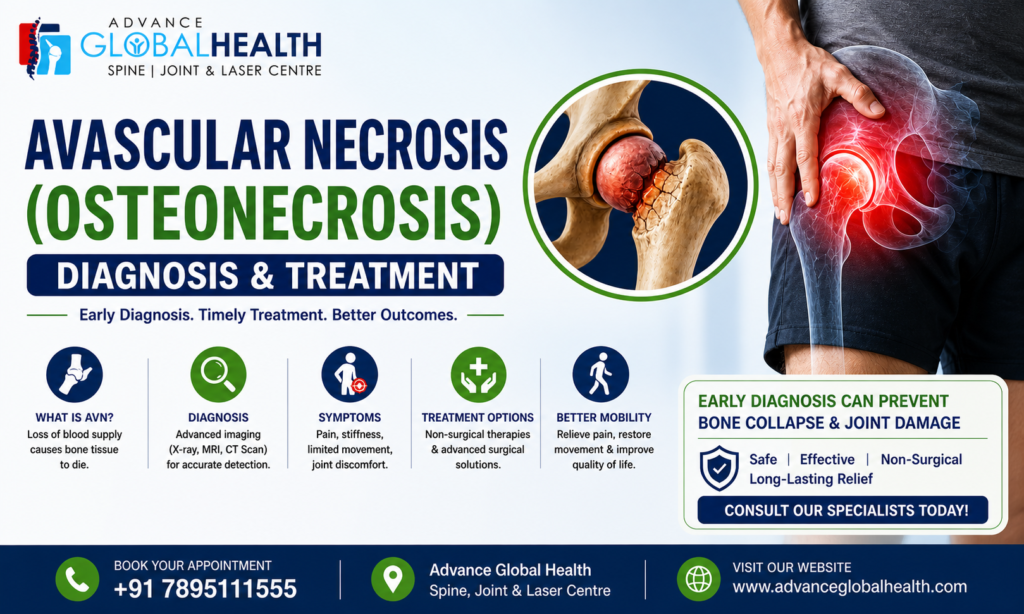 Avascular Necrosis (Osteonecrosis) – Diagnosis & Treatment